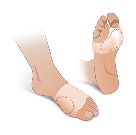 Protector Plantar e Hallux Valgus